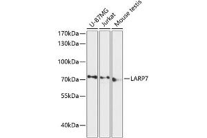 Western blot analysis of extracts of various cell lines, using L antibody (ABIN6128191, ABIN6143096, ABIN6143097 and ABIN6216959) at 1:3000 dilution. (LARP7 anticorps  (AA 160-380))