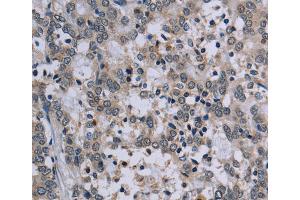 Immunohistochemistry (IHC) image for anti-P53-Regulated Apoptosis-Inducing Protein 1 (TP53AIP1) antibody (ABIN2435142) (TP53AIP1 anticorps)