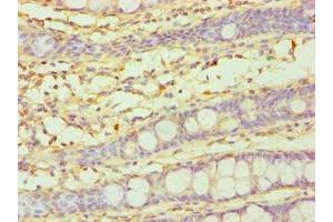 Immunohistochemistry of paraffin-embedded human colon tissue using ABIN7149265 at dilution of 1:100