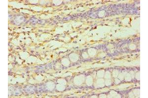 Immunohistochemistry of paraffin-embedded human colon tissue using ABIN7149265 at dilution of 1:100 (CYP3A5 anticorps  (AA 233-502))