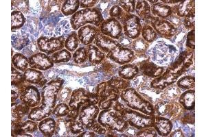 IHC-P Image GDI1 antibody detects GDI1 protein at cytosol on mouse kidney by immunohistochemical analysis. (GDI1 anticorps)