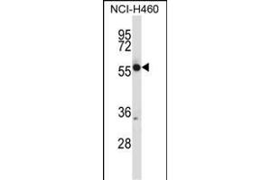 CR Antibody (N-term) (ABIN657682 and ABIN2846674) western blot analysis in NCI- cell line lysates (35 μg/lane). (CRMP1 anticorps  (N-Term))