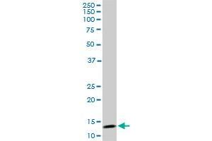 TOMM20 monoclonal antibody (M01), clone 4F3.