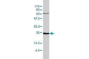 SDF2 monoclonal antibody (M01), clone 3G7-1D6 Western Blot analysis of SDF2 expression in WI-38 . (SDF2 anticorps  (AA 20-211))