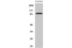 Western Blotting (WB) image for anti-Ewing Sarcoma Breakpoint Region 1 (EWSR1) (Internal Region) antibody (ABIN3175035) (EWSR1 anticorps  (Internal Region))