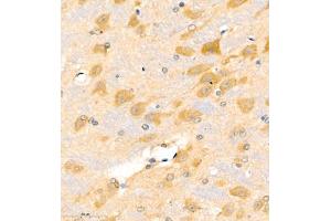 Immunohistochemistry of paraffin embedded rat brain using ptgds (ABIN7075207) at dilution of 1:1700 (400x lens)