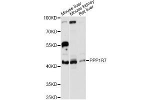 Western blot analysis of extracts of various cell lines, using PPP1R7 antibody (ABIN6293696) at 1:3000 dilution. (PPP1R7 anticorps)