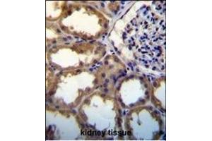PDGFC antibody (N-term) (ABIN650654 and ABIN2837869) immunohistochemistry analysis in formalin fixed and paraffin embedded human kidney tissue followed by peroxidase conjugation of the secondary antibody and DAB staining. (PDGFC anticorps  (N-Term))