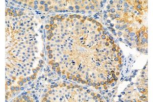 ABIN6264206 and ABIN6279656 at 1/100 staining Mouse testis tissue by IHC-P. (PIGP anticorps  (Internal Region))