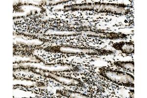 IHC analysis of SORBS3 using anti-SORBS3 antibody (ABIN7603121).