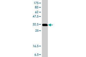 Western Blot detection against Immunogen (37.