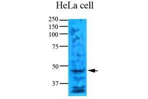 Western Blotting (WB) image for anti-Thymidylate Synthetase (TYMS) (AA 1-313), (N-Term) antibody (ABIN452662)