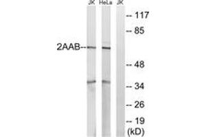 Western blot analysis of extracts from HeLa/Jurkat cells, using PPP2R1B Antibody. (PPP2R1B anticorps  (AA 552-601))