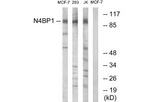 Western blot analysis of extracts from MCF-7 cells, 293 cells and Jurkat cells, using N4BP1 antibody. (N4BP1 anticorps  (Internal Region))