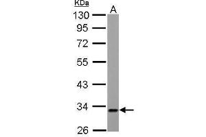 WB Image ETFA antibody detects ETFA protein by Western blot analysis. (ETFA anticorps  (Center))