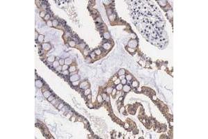 Immunohistochemical staining of human duodenum with FAM109B polyclonal antibody  shows moderate cytoplasmic and membranous positivity in glandular cells.