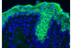 Image no. 3 for anti-Keratin 10 (KRT10) antibody (ABIN959490)