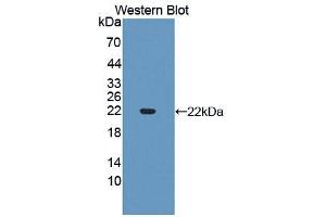 Western blot analysis of the recombinant protein. (SLIT3 anticorps  (AA 1405-1512))