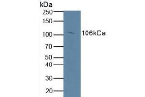 Detection of RB1 in Human Serum using Polyclonal Antibody to Retinoblastoma Protein 1 (RB1) (Retinoblastoma 1 anticorps  (AA 639-778))
