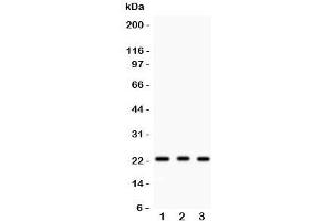 Western blot testing of MGMT antibody and human samples 1:  HeLa;  2: placenta;  3: Jurkat. (MGMT anticorps  (AA 2-207))