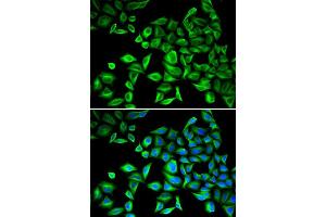 Immunofluorescence (IF) image for anti-C-Reactive Protein (CRP) (AA 1-224) antibody (ABIN3020716) (CRP anticorps  (AA 1-224))