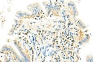 Immunohistochemistry analysis of paraffin-embedded mouse colon using SLK (ABIN7075729) at dilution of 1: 500 (SLK anticorps)