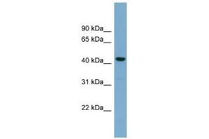 CDCA7L antibody used at 1 ug/ml to detect target protein. (CDCA7L anticorps  (Middle Region))