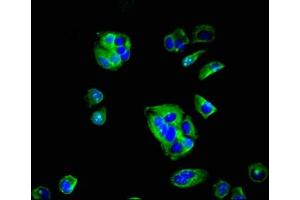 anti-F11 Receptor (F11R) (AA 31-224) antibody