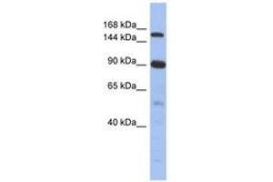 Image no. 1 for anti-Nuclear Receptor Coactivator 2 (NCOA2) (N-Term) antibody (ABIN6742809) (NCOA2 anticorps  (N-Term))