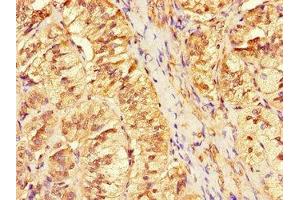 Immunohistochemistry of paraffin-embedded human adrenal gland tissue using ABIN7144308 at dilution of 1:100 (Anoctamin 4 anticorps  (AA 1-200))