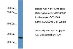 Western Blotting (WB) image for anti-Yip1 Domain Family, Member 4 (YIPF4) (N-Term) antibody (ABIN2788486) (YIPF4 anticorps  (N-Term))