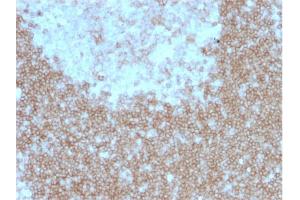 Formalin-fixed, paraffin-embedded human Tonsil stained with CD268 / BAFFR Mouse Monoclonal Antibody (BAFFR/1557). (TNFRSF13C anticorps)