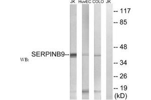 Western blot analysis of extracts from Jurkat cells, using SERPINB9 antibody. (SERPINB9 anticorps  (Internal Region))
