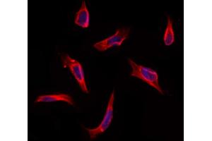 ABIN6260916 and ABIN6273211 staining Hela by IF/ICC.