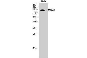 Western Blotting (WB) image for anti-Mdm2, p53 E3 Ubiquitin Protein Ligase Homolog (Mouse) (MDM2) (Ser880) antibody (ABIN3180170) (MDM2 anticorps  (Ser880))
