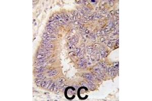 Immunohistochemistry (IHC) image for anti-phosphodiesterase 8A (PDE8A) antibody (ABIN2998130) (PDE8A anticorps)