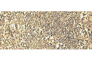 Immunohistochemistry of paraffin-embedded Human tonsil tissue using UNKL Polyclonal Antibody at dilution of 1:50(x200) (UNKL anticorps)