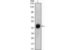 Western blot analysis using FOXA2 mouse mAb against A549 (1) cell lysate. (FOXA2 anticorps)