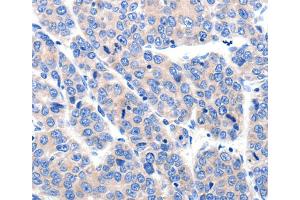 Immunohistochemistry (IHC) image for anti-Potassium Voltage-Gated Channel, Subfamily H (Eag-Related), Member 8 (KCNH8) antibody (ABIN2431491)