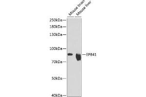 Western blot analysis of extracts of various cell lines, using EPB41 Antibody (ABIN6132258, ABIN6140197, ABIN6140198 and ABIN6216056) at 1:1000 dilution. (EPB41 anticorps  (AA 210-500))