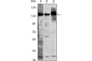 Western blot analysis using SMC1 mouse mAb against K562 (1), Jurkat (2) and A549 (3) cell lysate. (SMC1A anticorps)