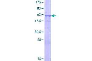 Image no. 1 for MAD2L1 Binding Protein (MAD2L1BP) (AA 1-306) protein (GST tag) (ABIN1309995)
