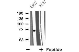 Western blot analysis of extracts from K562 cells, using GAB2 antibody. (GAB2 anticorps  (C-Term))