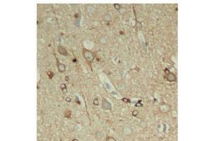 Immunohistochemistry of paraffin-embedded Rat hippocampal region tissue from a model with Alzheimer, using Phospho-Tau(S396) Polyclonal Antibody (tau anticorps  (pSer396))