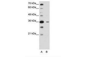 Image no. 2 for anti-DAZ Associated Protein 1 (DAZAP1) (C-Term) antibody (ABIN6736222) (DAZAP1 anticorps  (C-Term))