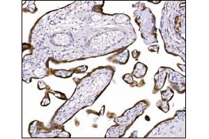 IHC analysis of NDEL1 using anti-NDEL1 antibody (ABIN7602511). (NDEL1 anticorps  (AA 80-320))