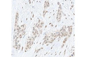 Immunohistochemistry (IHC) image for anti-Proprotein Convertase Subtilisin/kexin Type 2 (PCSK2) (AA 150-200) antibody (ABIN7454823)