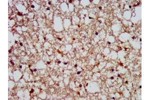 IHC image of ABIN7169777 diluted at 1:300 and staining in paraffin-embedded human brain tissue performed on a Leica BondTM system. (SLAIN1 anticorps  (AA 43-136))
