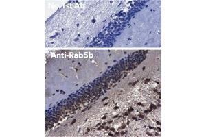 Immunohistochemistry (IHC) image for anti-RAB5B, Member RAS Oncogene Family (RAB5B) (C-Term) antibody (ABIN1439995)