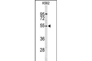Western blot analysis of RPS6KB2 Antibody (ABIN652424 and ABIN2842096) in K562 cell line lysates (35 μg/lane). (RPS6KB2 anticorps)
